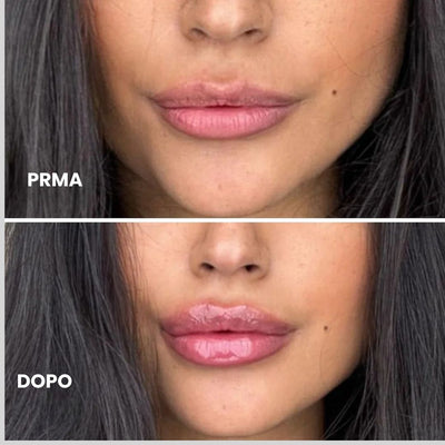 Rimpolpante per labbra  OMY BEAUTY 1+1 GRATIS